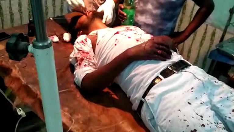 ফের নৈহাটিতে দুষ্কৃতী হামলায় আক্রান্ত এক বিজেপি কর্মীর।