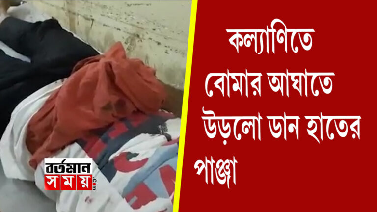 বোমা বাঁধতে গিয়ে আহত কল্যাণী শরৎপল্লী এলাকার এক যুবক