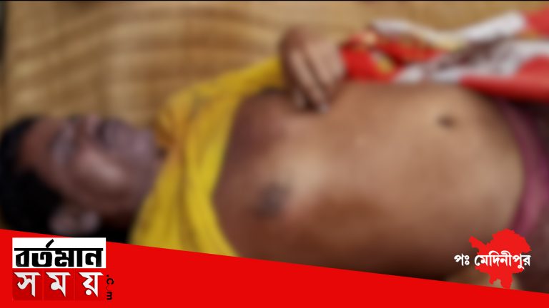 সোমবার মাঝরাতে গলায় ফাঁস লাগিয়ে মৃত্যু হল এক ব্যাক্তির