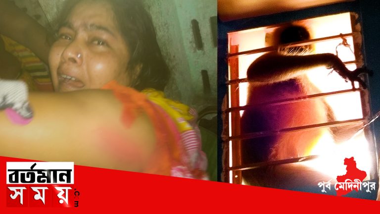 পুর্ব মেদিনীপুরে হনুমানের কামড়ে আহত ৩০,আতঙ্ক এলাকায়