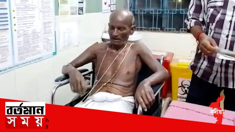 গ্যাস সিলিন্ডার থেকে ঘরে আগুন লেগে অগ্নিদগ্ধ হয়ে গুরুতর আহত হলেন এক বৃদ্ধ।