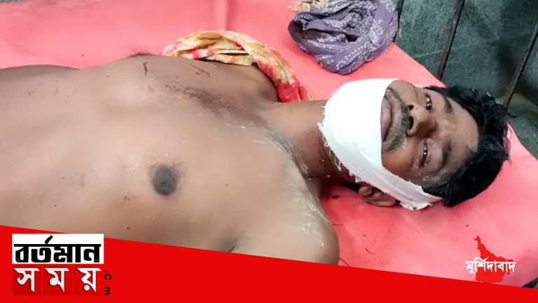 কম উঠার অভিযোগে পাম্প চালককে মাঠে ডেকে নিয়ে গিয়ে খুনের চেষ্টা প্রতিবেশীদের বিরুদ্ধে।