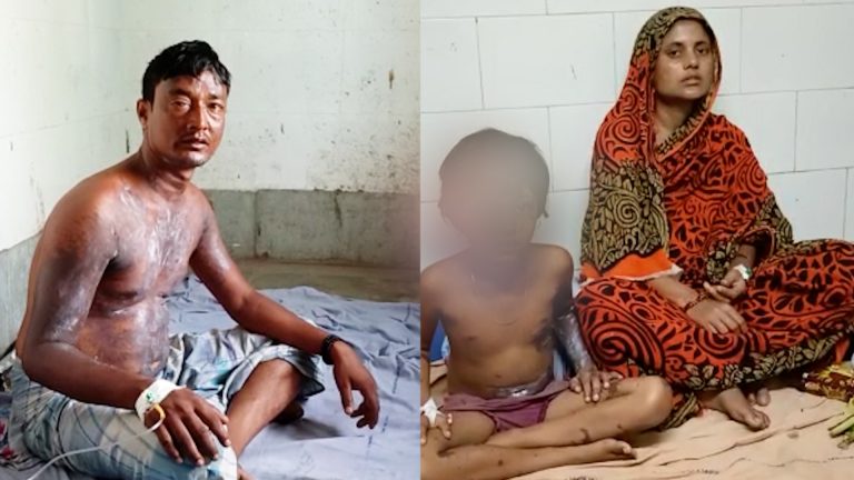 গভীর রাতে এক পরিবারকে অ্যাসিড ছোড়ার অভিযোগ