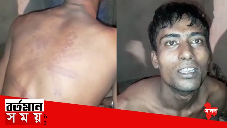 একটি নেশামুক্তি কেন্দ্রে এক যুবককে ব্যাপক মারধরের অভিযোগ দুই কর্তৃপক্ষের বিরুদ্ধে