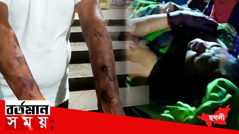 আতশবাজি পোড়ানো নিয়ে মারধরের অভিযোগ কোন্নগরে