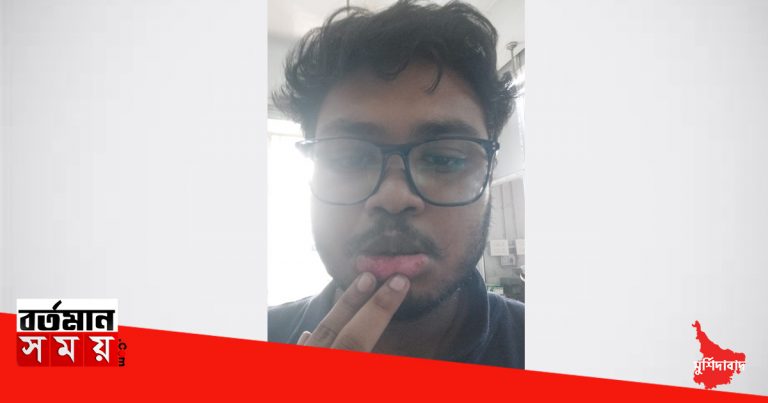 মুর্শিদাবাদে সরকারি হাসপাতালের জুনিয়র চিকিৎসককে মারধরের অভিযোগ উঠল রোগীর আত্মীয়র বিরুদ্ধে।