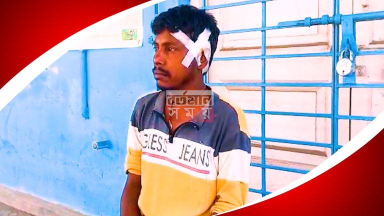 মালদায় জামাইয়ের কান কাটার অভিযোগ উঠলো শাশুড়ির বিরুদ্ধে।