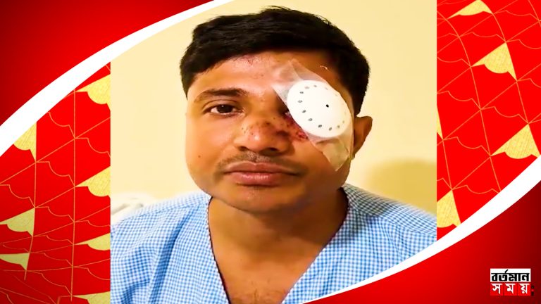 চোখের চিকিৎসার উদ্দেশ্যে হায়দ্রাবাদে রওনা, নবান্ন অভিযানে আক্রান্ত পুলিশকর্মী।