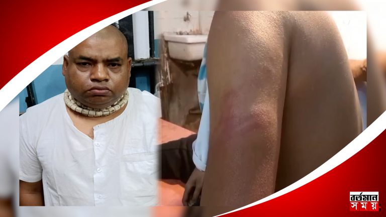 উচ্চ মাধ্যমিক পরীক্ষার্থীকে বাড়ীতে ডেকে নিয়ে গিয়ে মারধর করার অভিযোগ !